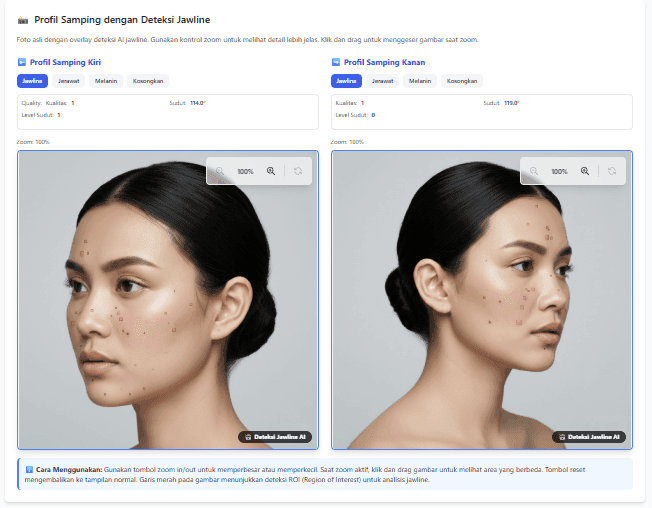 Contoh profil samping Advanced Skin Analysis